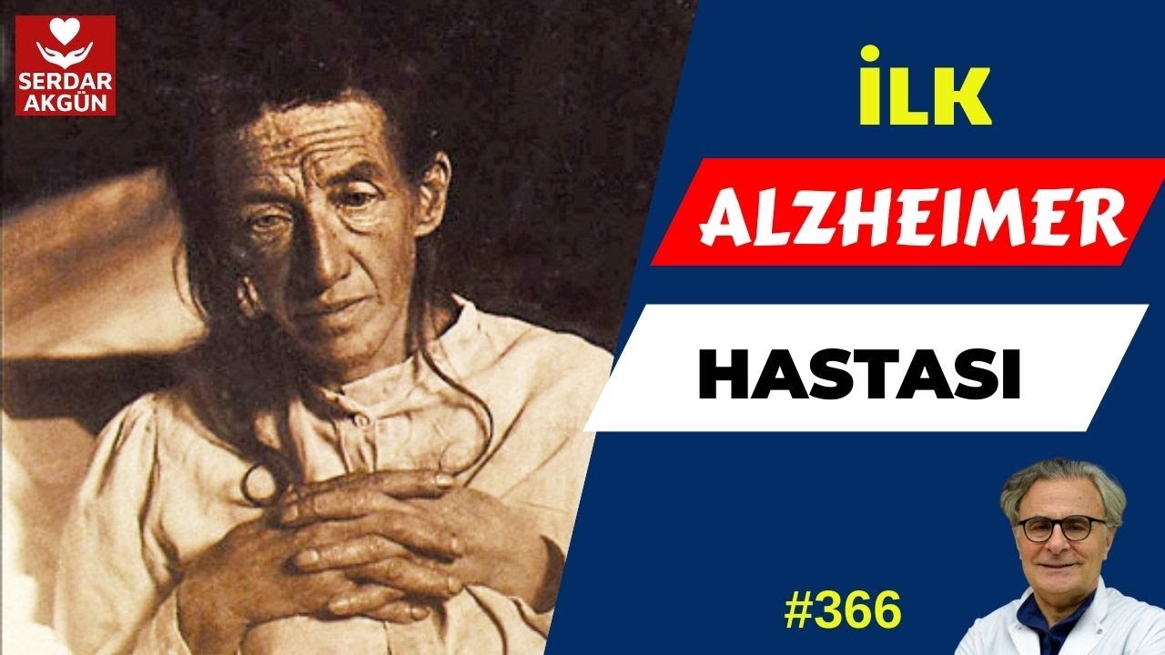 366. İlk Alzheimer Hastası kimdi? Alzheimer Hastalığı Nasıl bulundu?