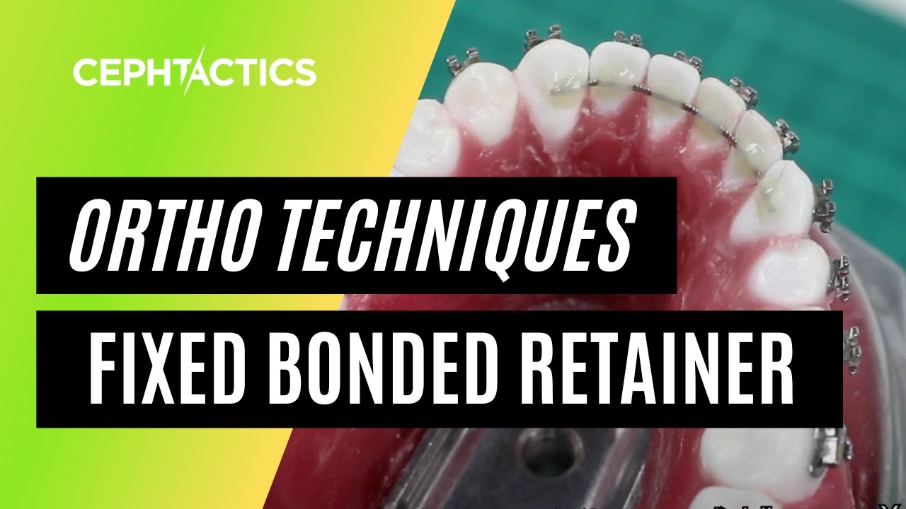 Fixed Bonded Retainer