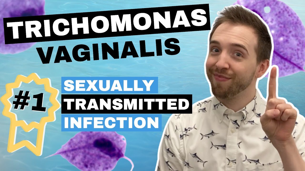 Лечение трихомониаза (Trichomonas Vaginalis) (наиболее распространенного ЗППП)