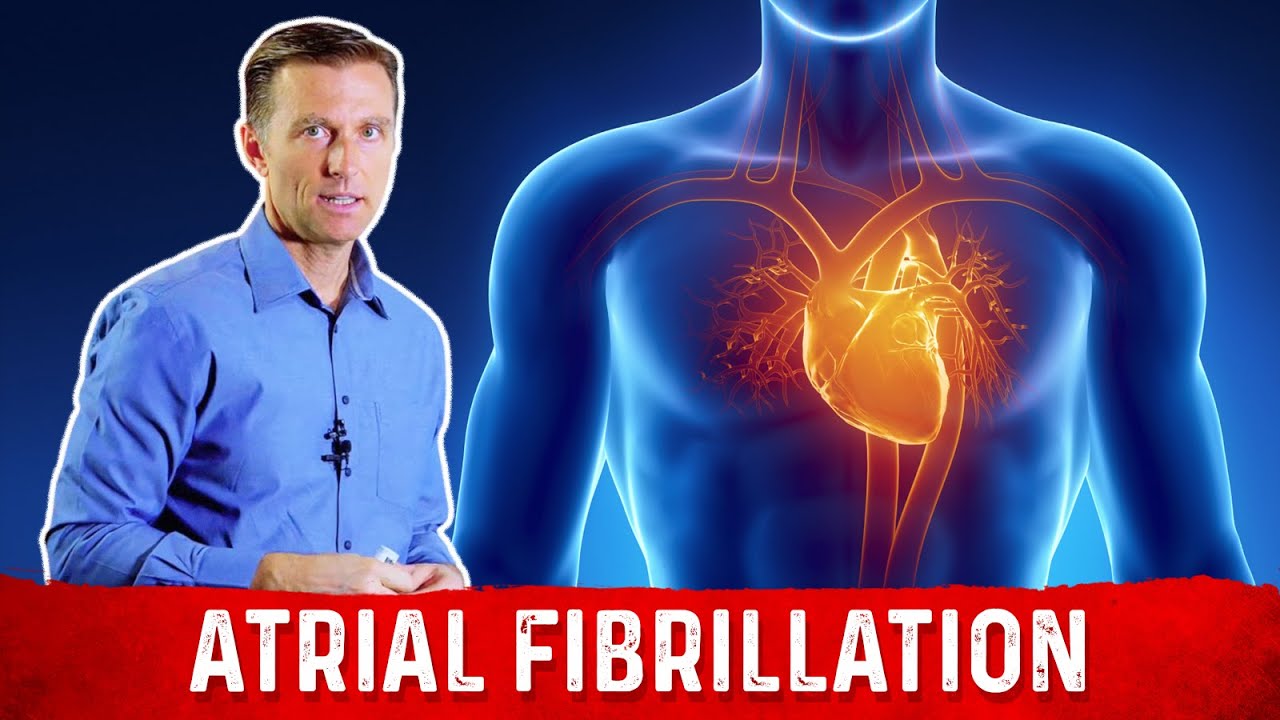 The Best Atrial Fibrillation Guidelines &ndash; Dr. Berg
