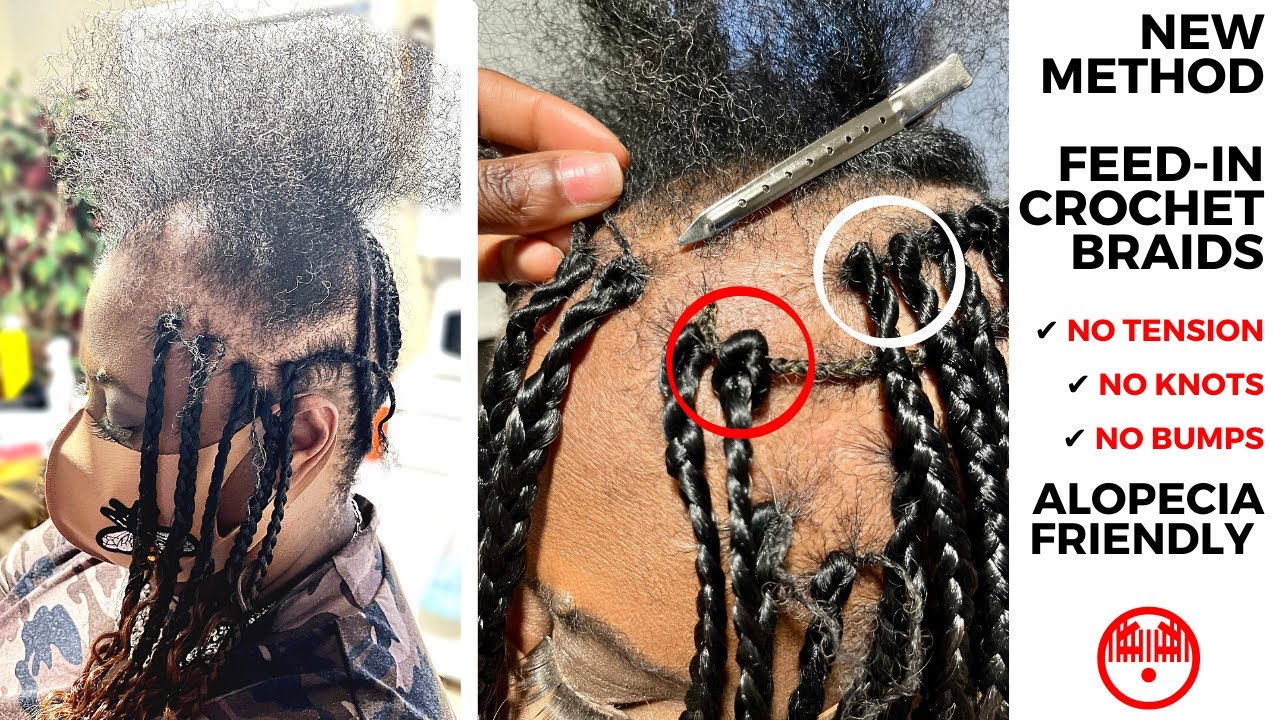Alopecia Edition: NO TENSION Feed-in Crochet Braids 🔥🔥🔥 NEXT BEST TECHNIQUE To Individual Crochet