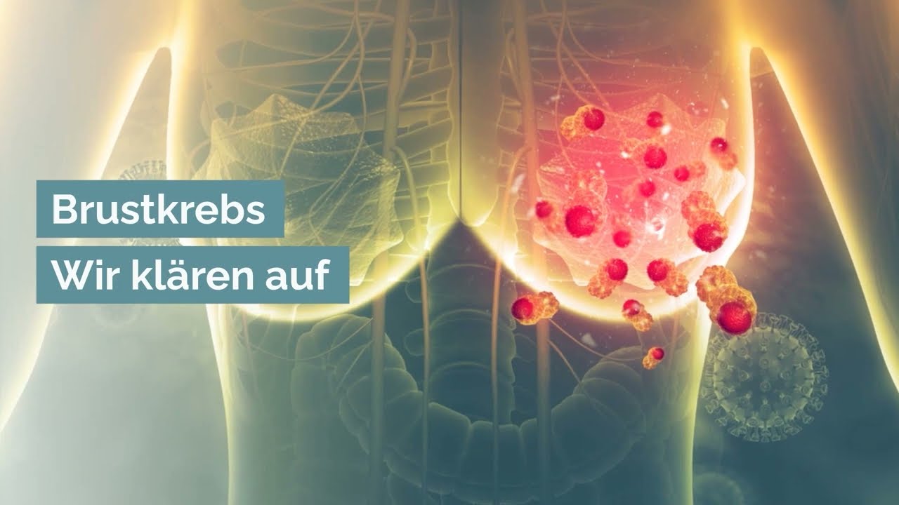 Brustkrebs: Häufigkeit, Risikofaktoren, Vorsorge