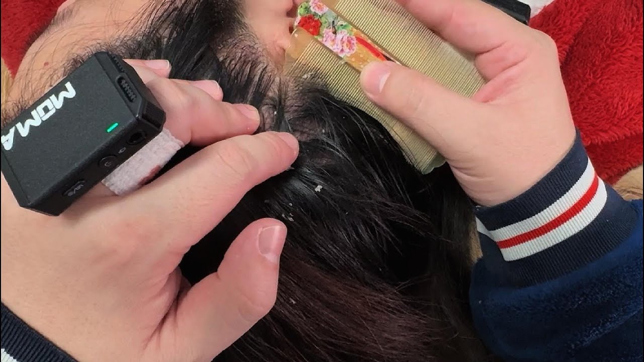 ASMR Satisfying Scalp Cleaning with Tweezer & Comb – No Talking