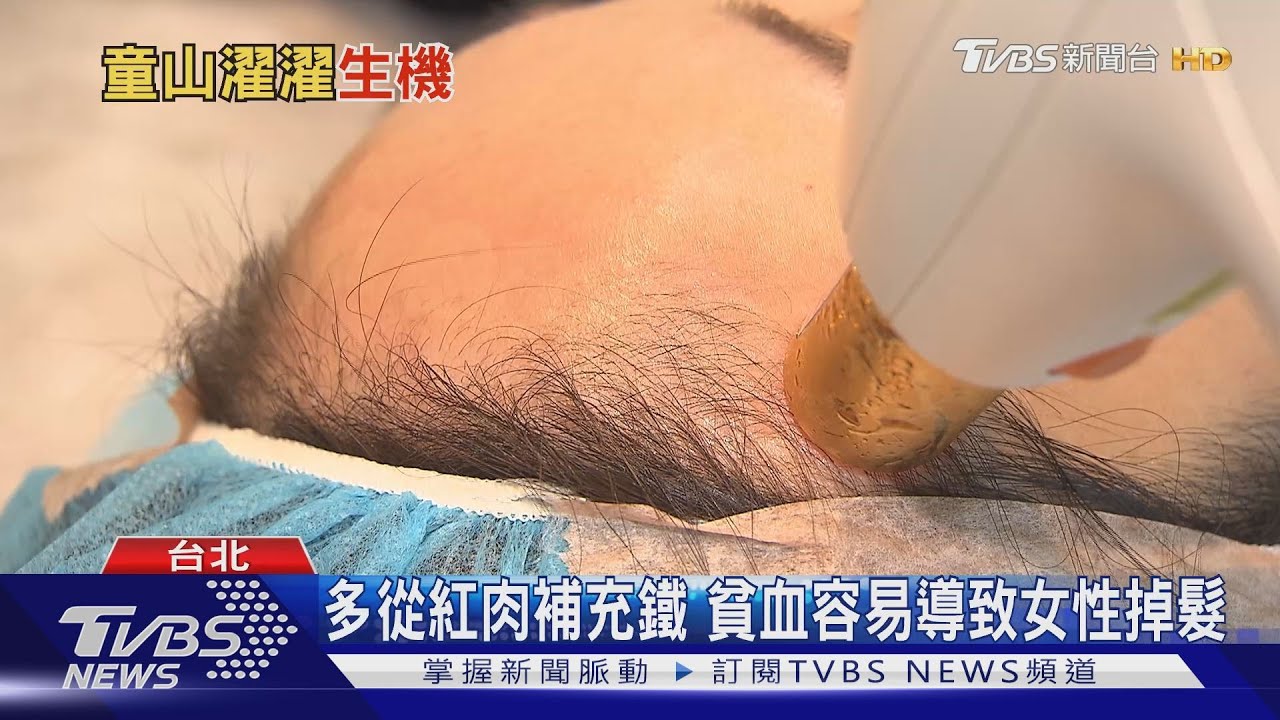 【十點不一樣】禿頭救星! 台大研究