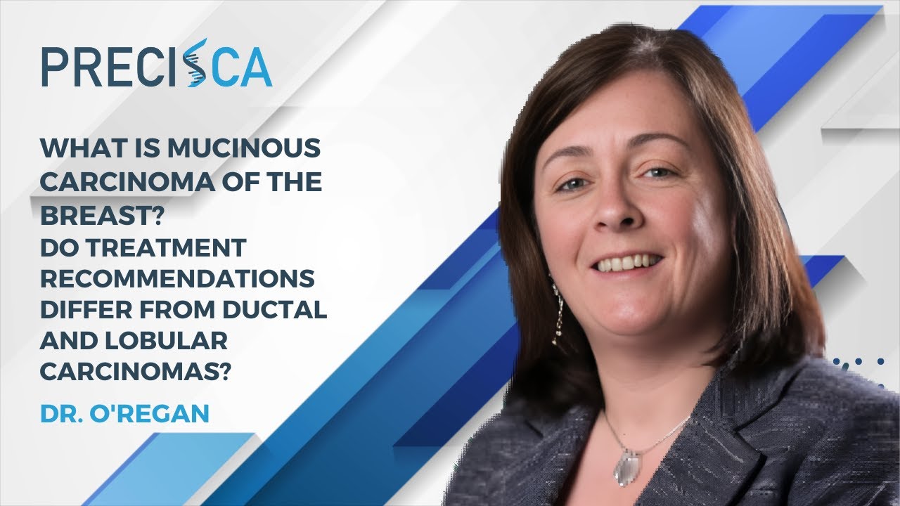 Что такое муцинозная карцинома молочной железы? Отличается ли лечение от лечения других видов рак...