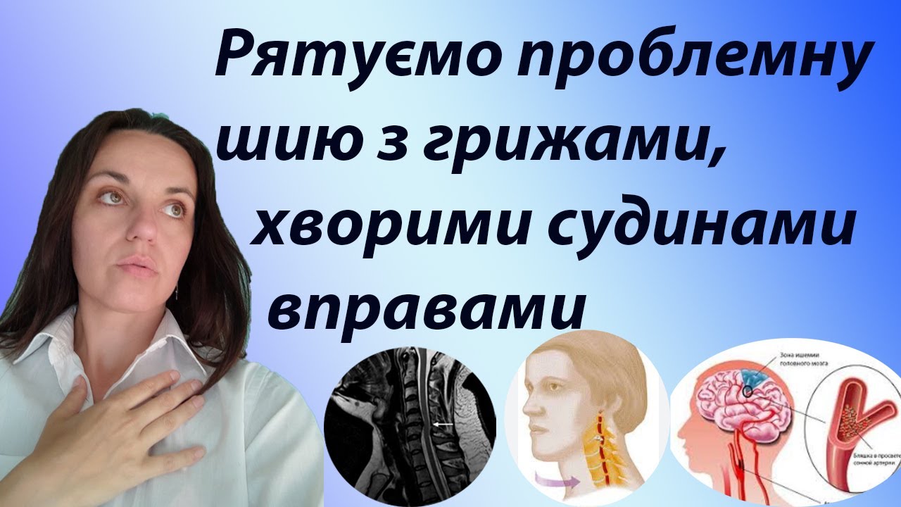 Вправи при грижі в шийному відділі хребта, при порушеннях мозкового кровообігу, після інсульту