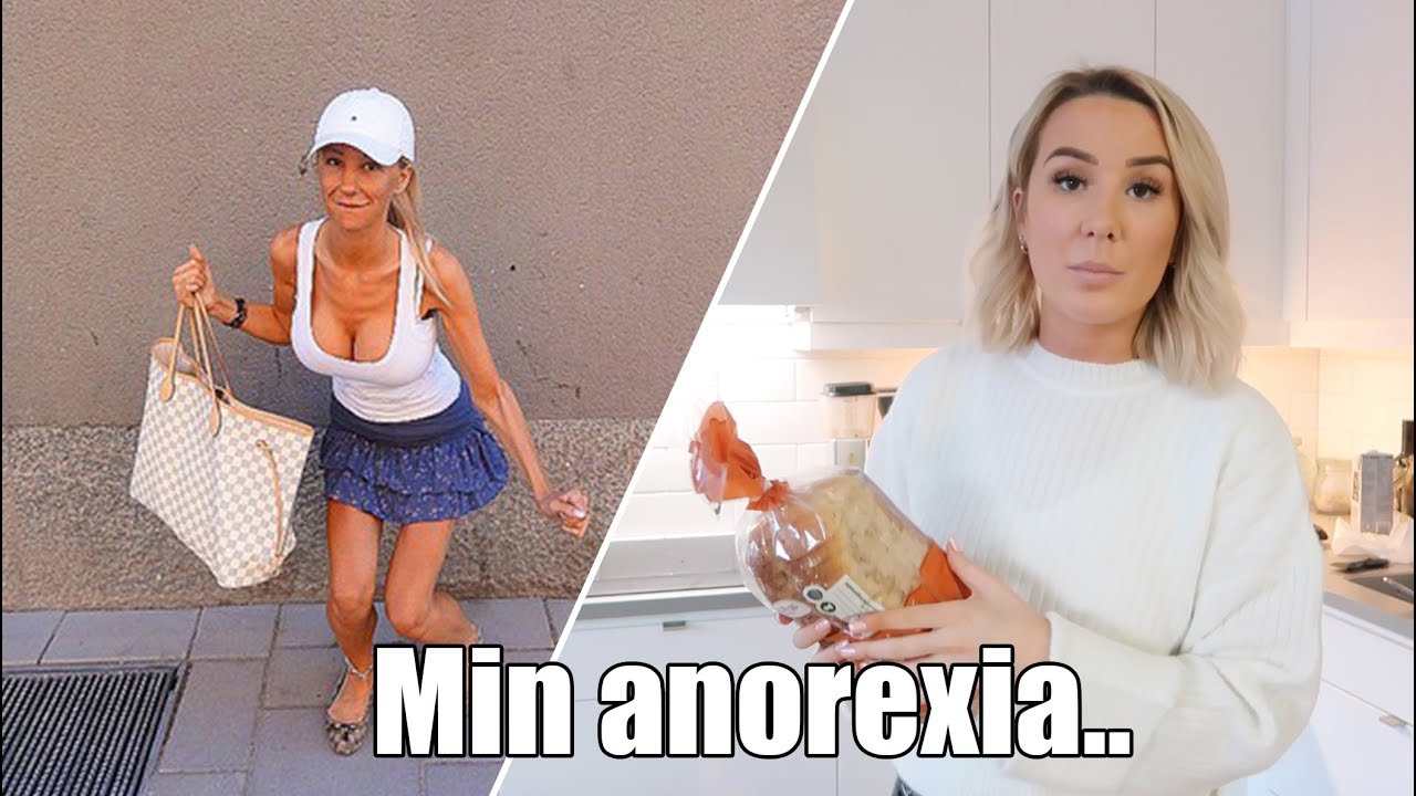 Min anorexia historia. Förbjuden mat och jobbiga kommentarer..