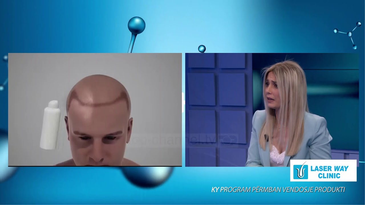 Hipokrati - Mbjellja e flokëve - Metoda e re DHI - 30 Maj 2020