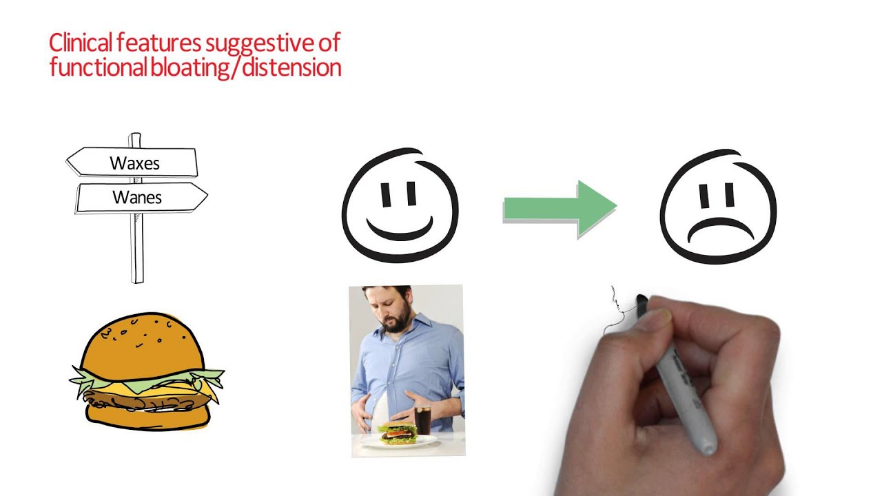 Abdominal bloating and distension - Clinical features