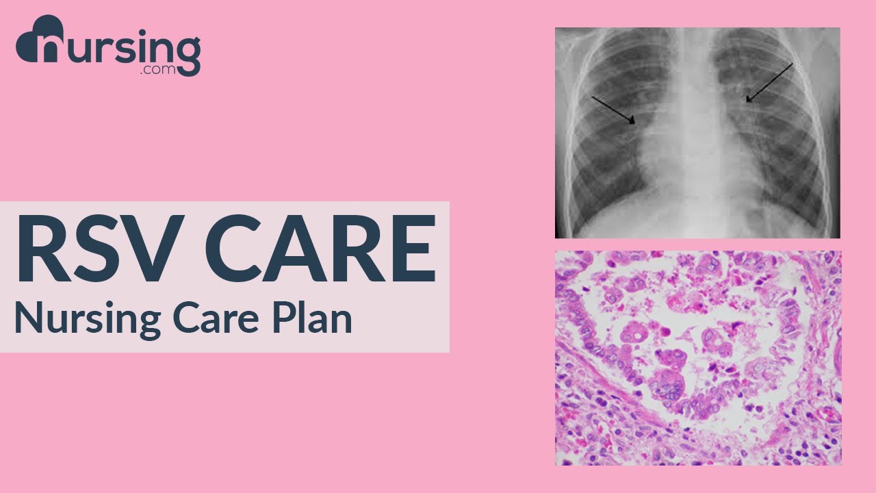 How to Diagnose Bronchiolitis or Respiratory Syncytial Virus (RSV).. Nursing Care Plan