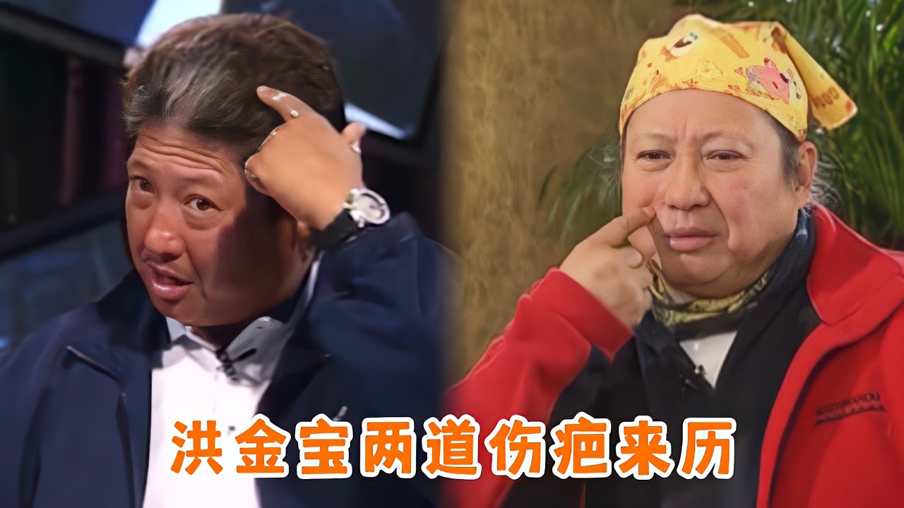洪金宝两道伤疤来历，受伤后于占元烟丝治疗，嘴角疤痕来自可乐瓶