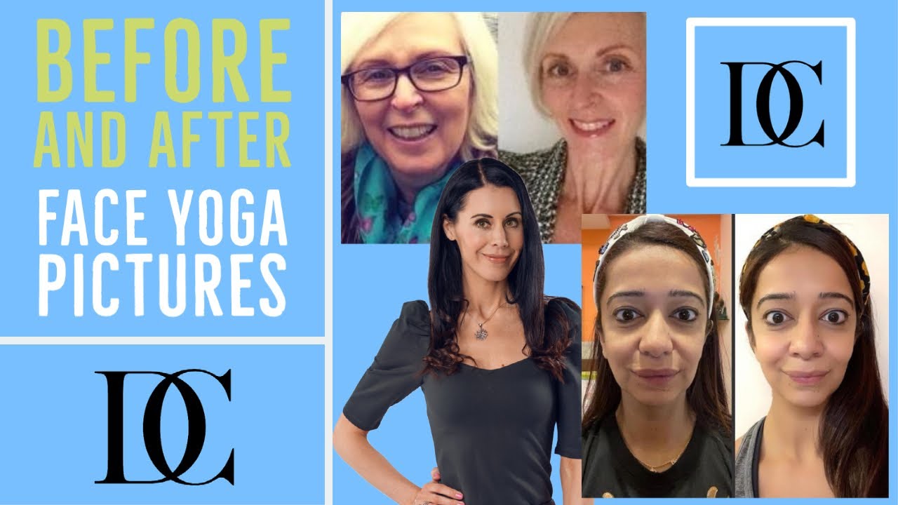 Before And After Face Yoga Pictures