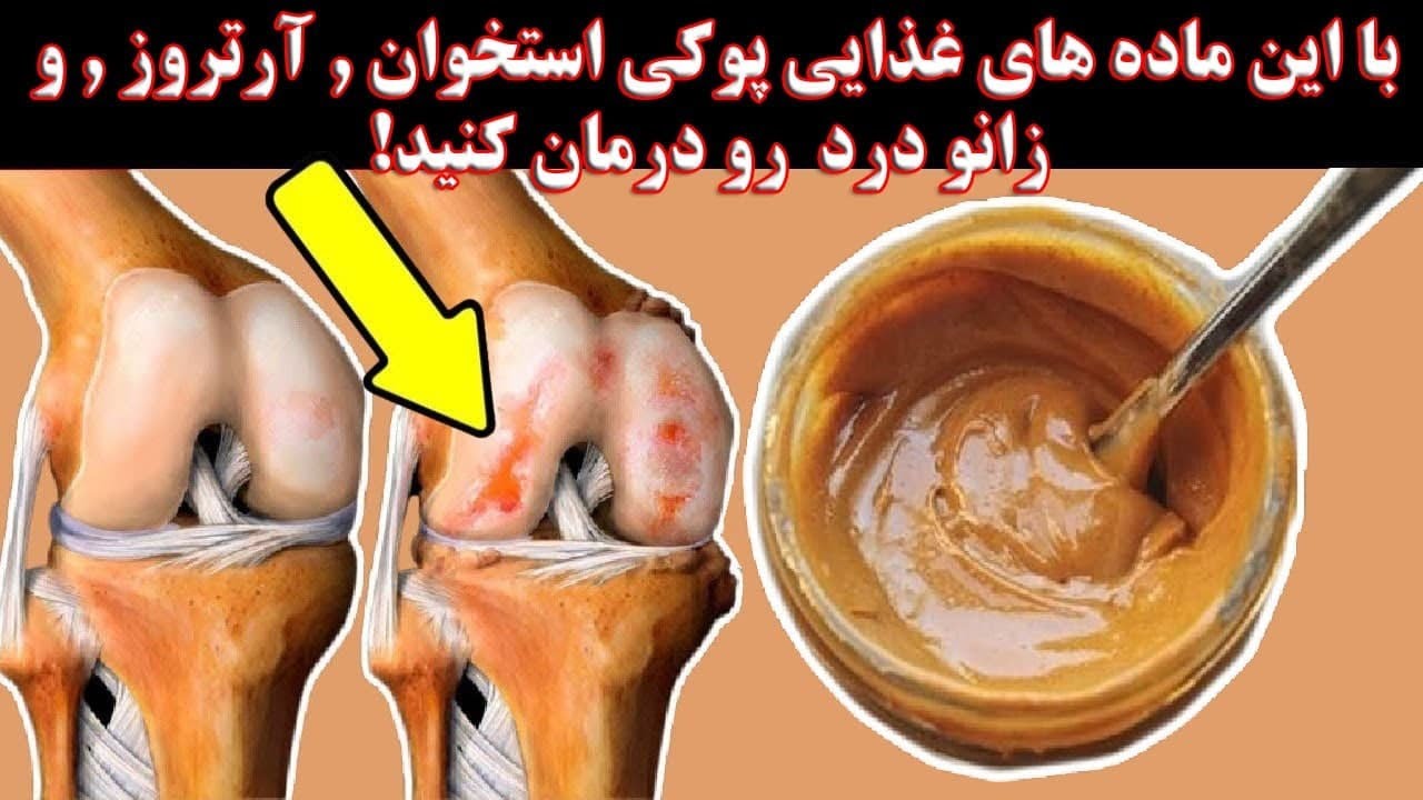 با این ماده های غذایی پوکی استخوان , آرتروز , و زانو درد رو درمان کنید!