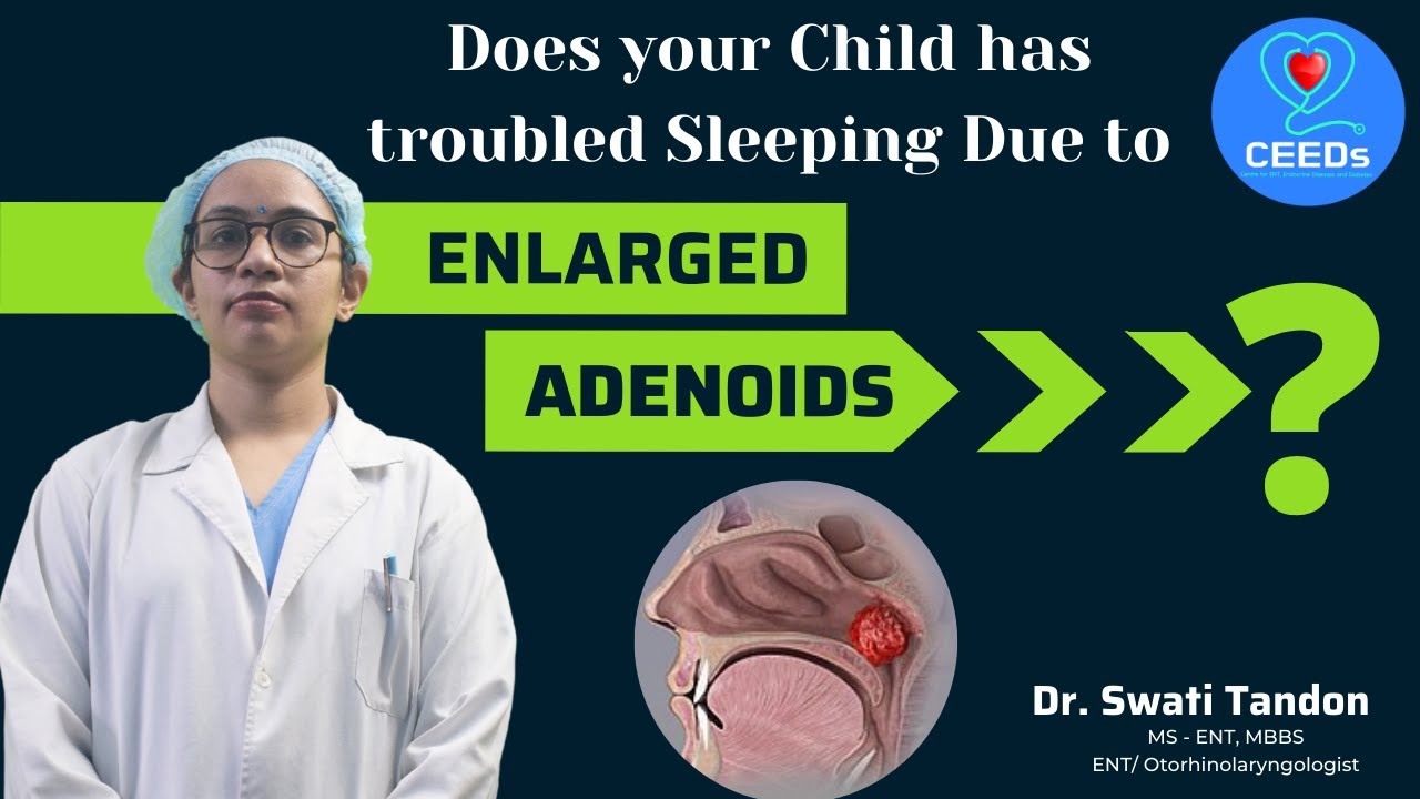 Does your Child has troubled Sleeping Due to ENLARGED ADENOIDS ? | Dr. Swati Tandon, ENT Specialist.