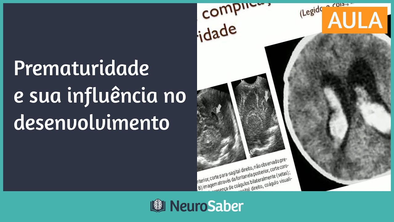 PREMATURIDADE e sua influência no desenvolvimento | NeuroSaber