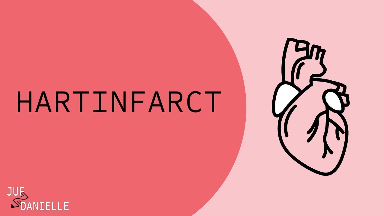 Hartinfarct