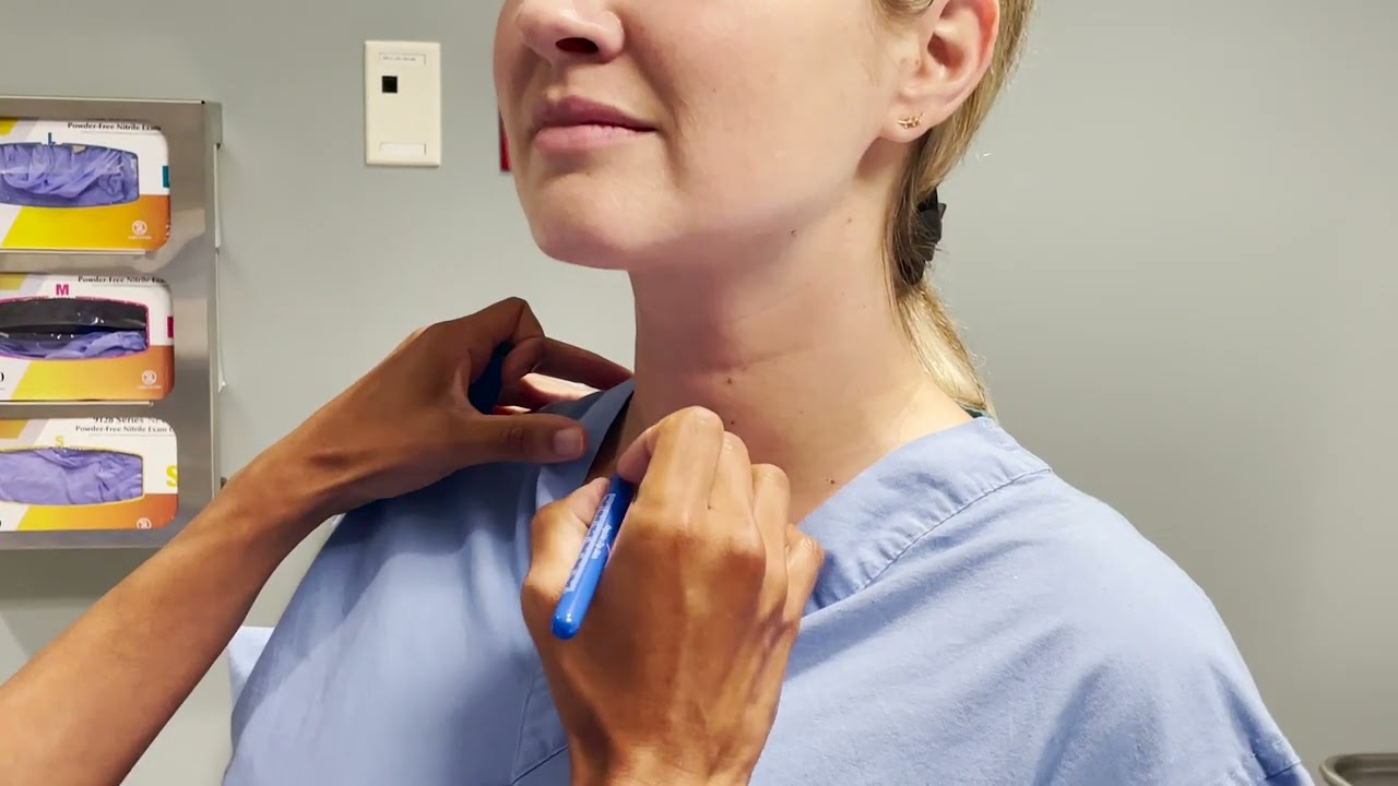 Worried about the scar from your thyroid surgery? Don't be! Dr. Roy explains the art of the incision