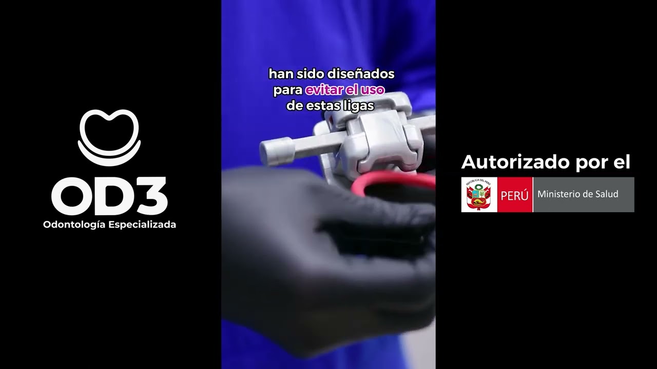 Brackets de Autoligado Damon - Brackets en Lima