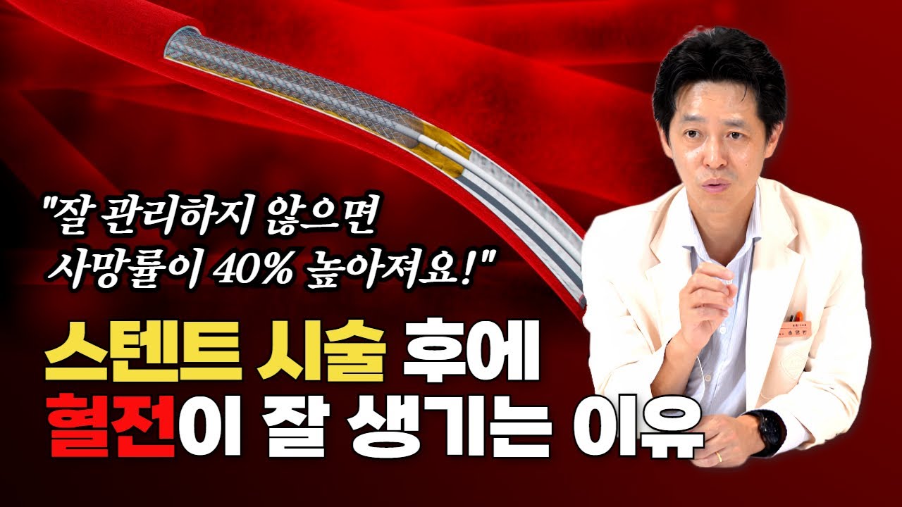 스텐트 시술 후 관리 feat. 아스피린 관련 질문 모음 | 삼성서울병원 송영빈 교수