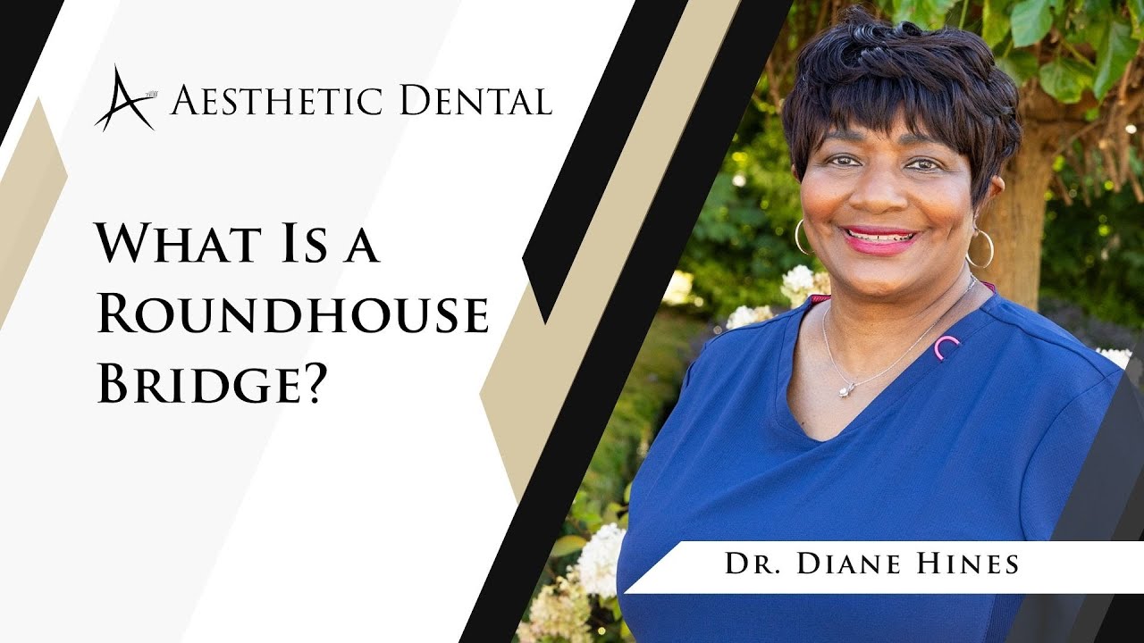 What Is a Roundhouse Bridge? | Implant Dentures in Southfield, MI | Aesthetic Dental