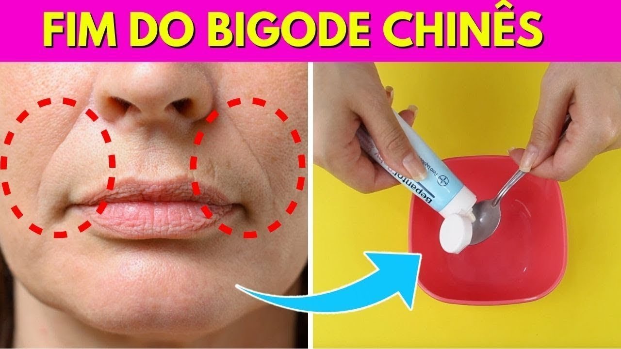 COMBATE RUGAS E BIGODE CHINES COM ESSA PODEROSA RECEITA EFEITO LIFTING! por Julia Doorman