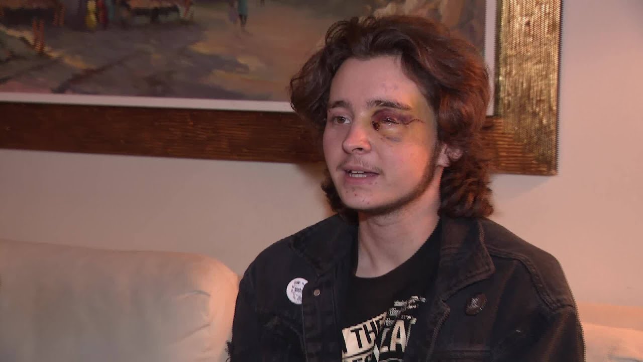 Protester blinded by federal agent in O.C. speaks out