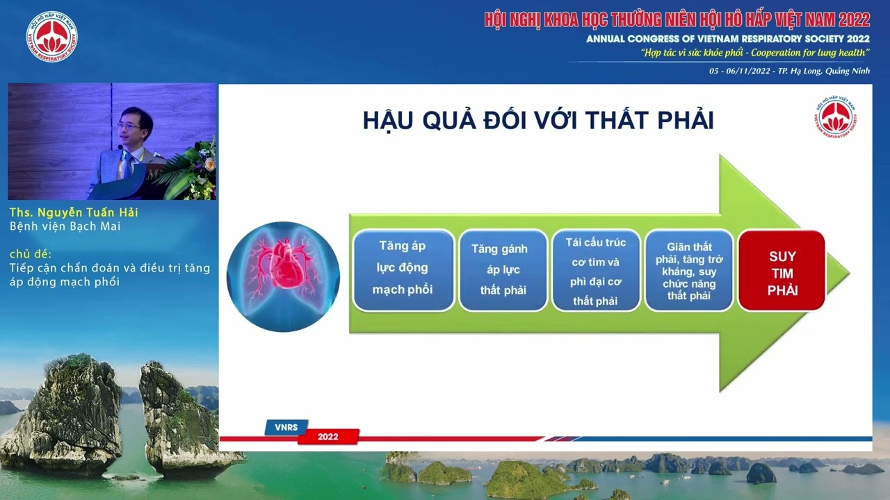 S16.1-Tiếp cận chẩn đoán và điều trị tăng áp động mạch phổi