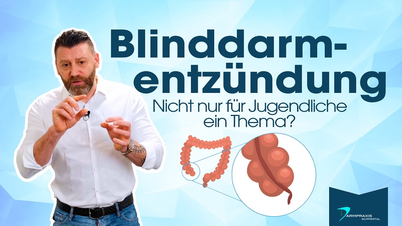 Blinddarmentzündung - Ab wann muss ich zum Arzt? (Proktologe klärt auf)