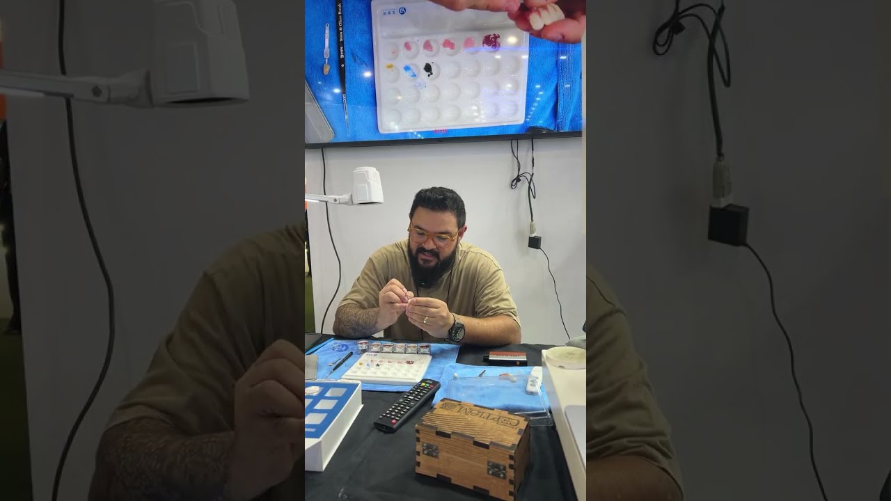 Richard Barbosa's Hands-on:  Full Arch Esthetic Design《Stain, Glow & Play- Yucera Color Glow 》