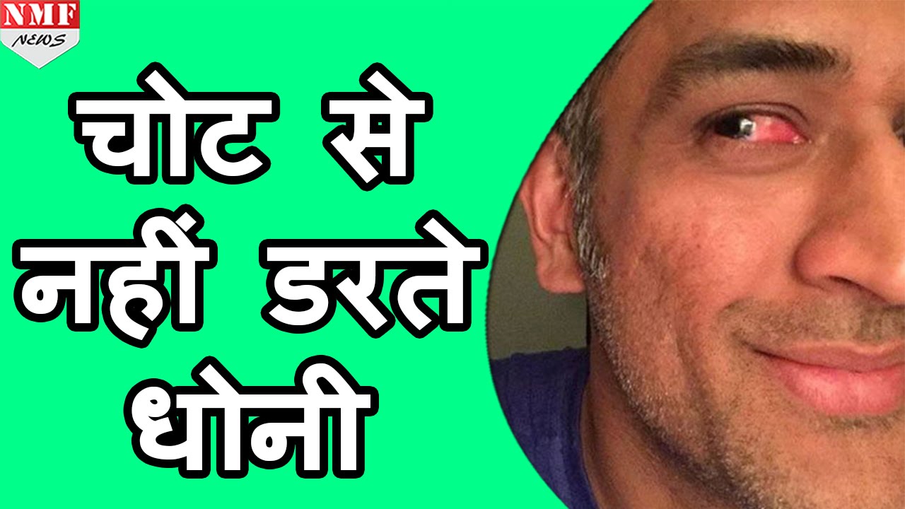 Injury भी नहीं रोक पाई Dhoni को, चोट लगने के बाद भी की wicket keeping