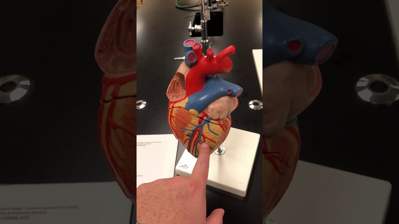 Aorta and Venae Cavae