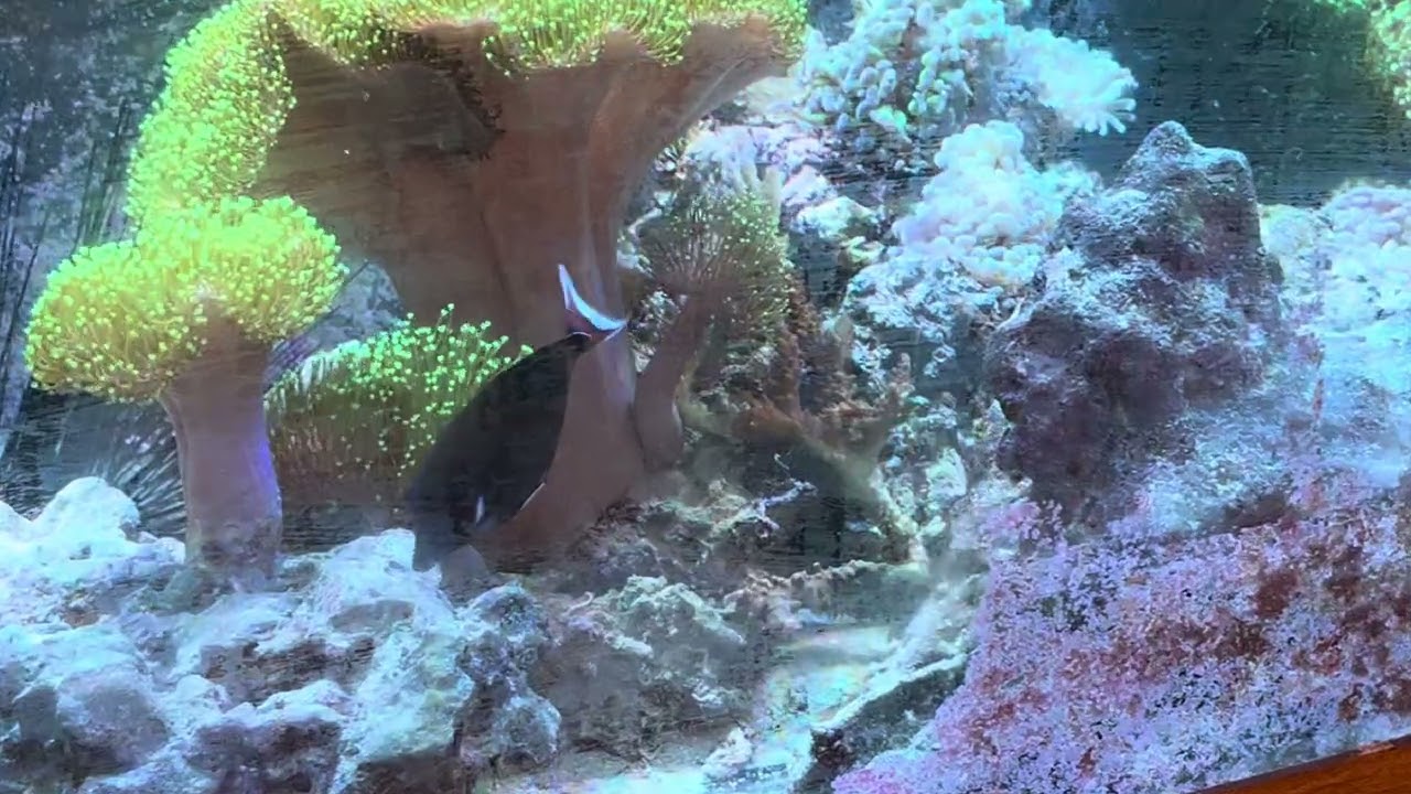 Achilles tang
