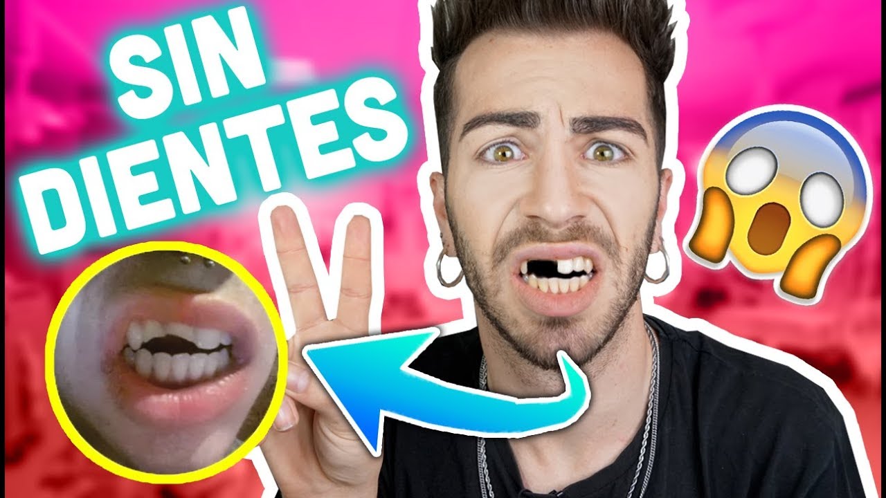 😰DRAMA😰 I BROKE TWO TEETH in front of 100 people.. | MALBERT