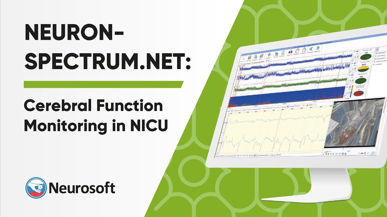 Cerebral Function Monitoring in NICU | Neuron-Spectrum.NET Software