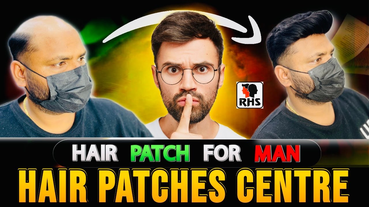 Best Affordable Hair Patch | Best Hair Patch For Men |  Best Hair Patch Centre | 9599858612