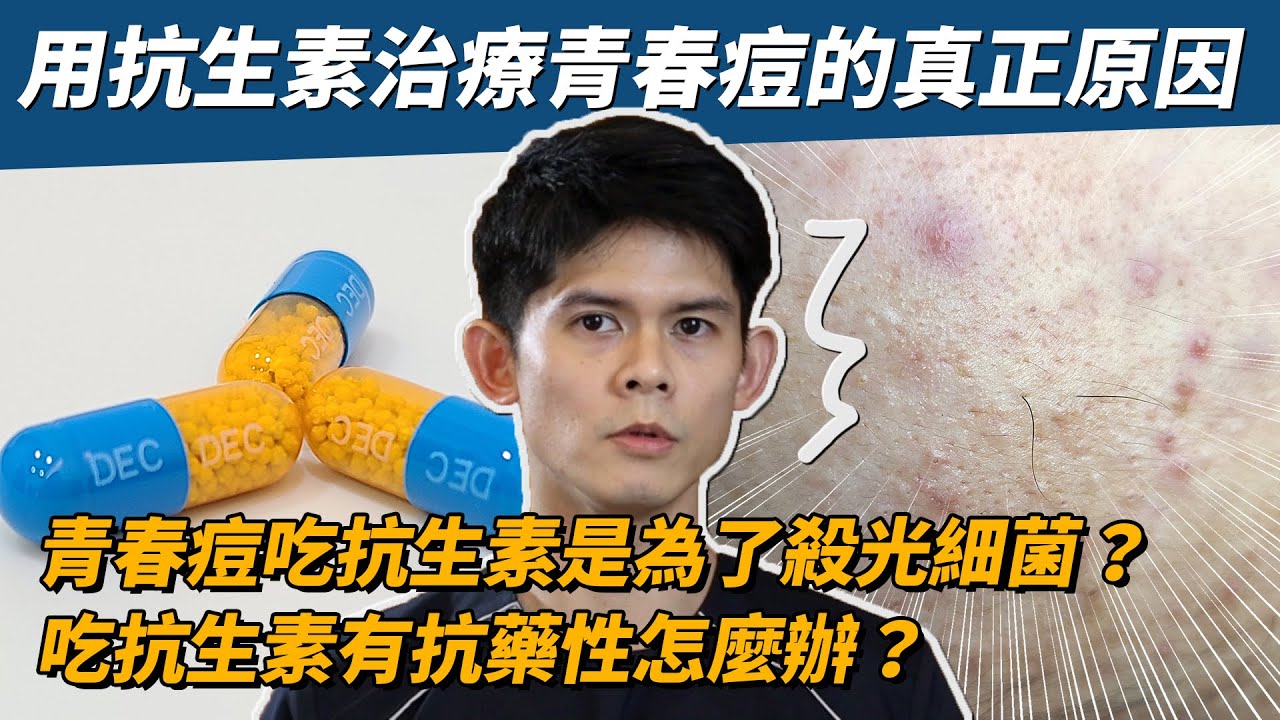 【耀哥來聊】青春痘吃抗生素是為了殺光細菌？用抗生素治療青春痘的真正原因