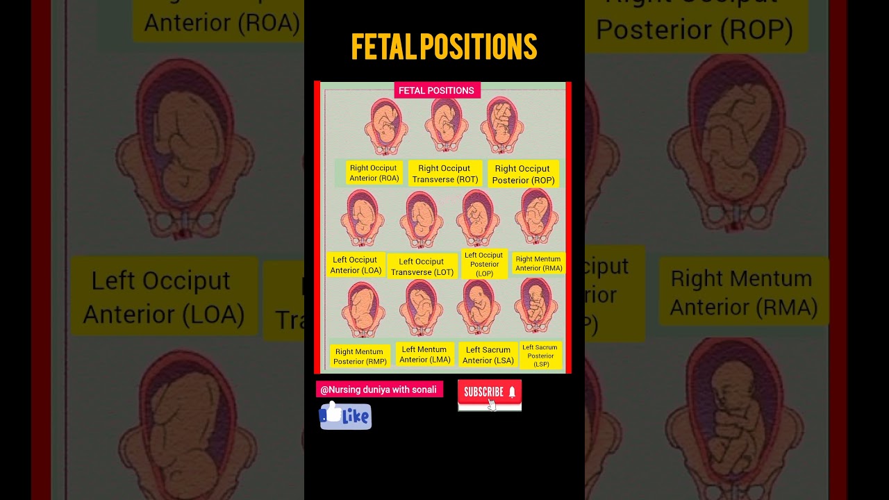 Fetal positions🚼