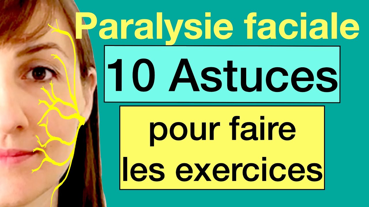 Paralysie faciale, 10 Astuces pour les exercices faciaux, Paralysie de Bell, prévenir syncinésies