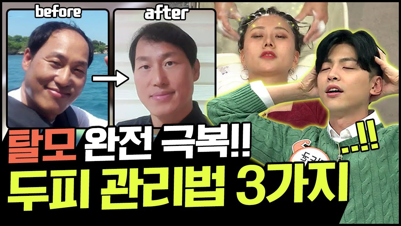 [Balance Of Life] ※탈모人 주목※ 탈모 관리법, 딱 3가지만 기억하자!｜나는 몸신이다 | 나는 몸신이다 312 회