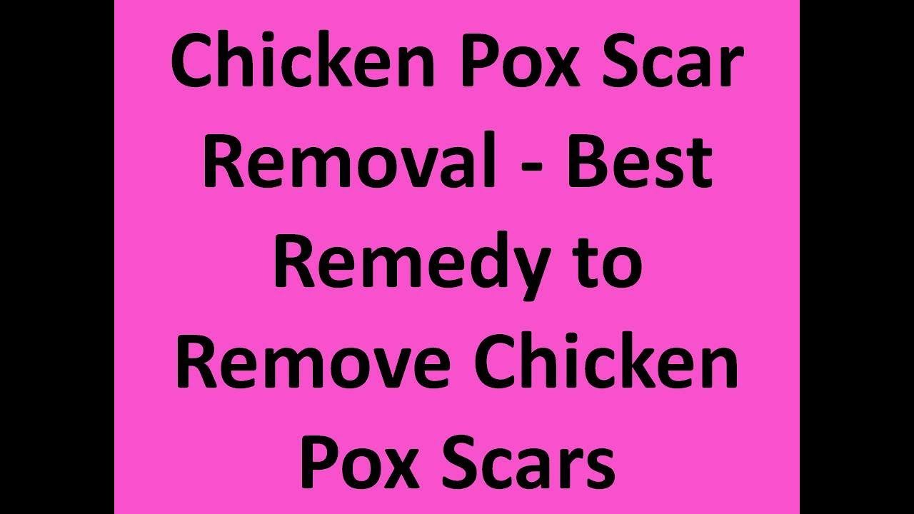 Chicken Pox Scar Removal  -  Best Remedy to Remove Chicken Pox Scars
