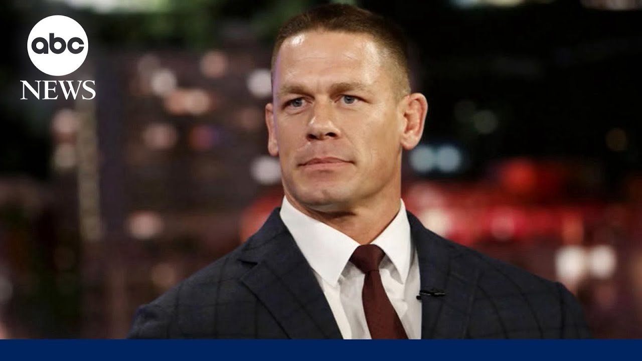More and more Hollywood men reveal their hair transplants