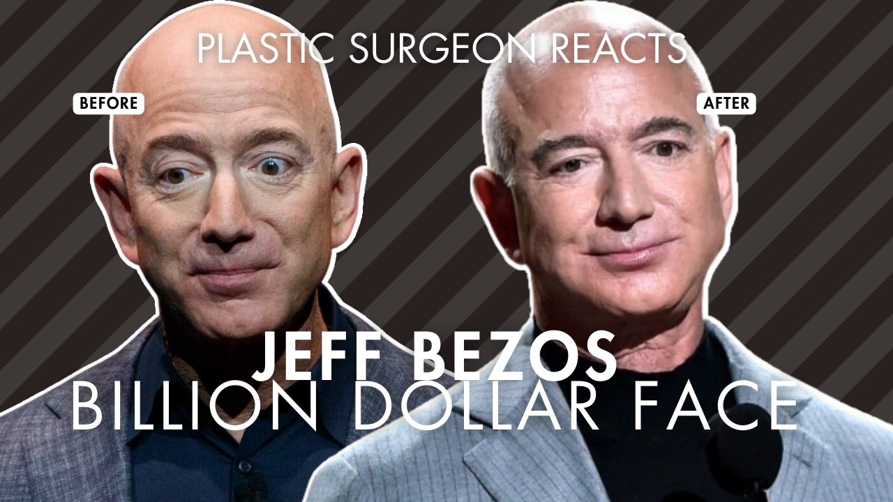 Jeff Bezos New Face: Biohacking or Plastic Surgery? Plastic Surgeon Reacts.