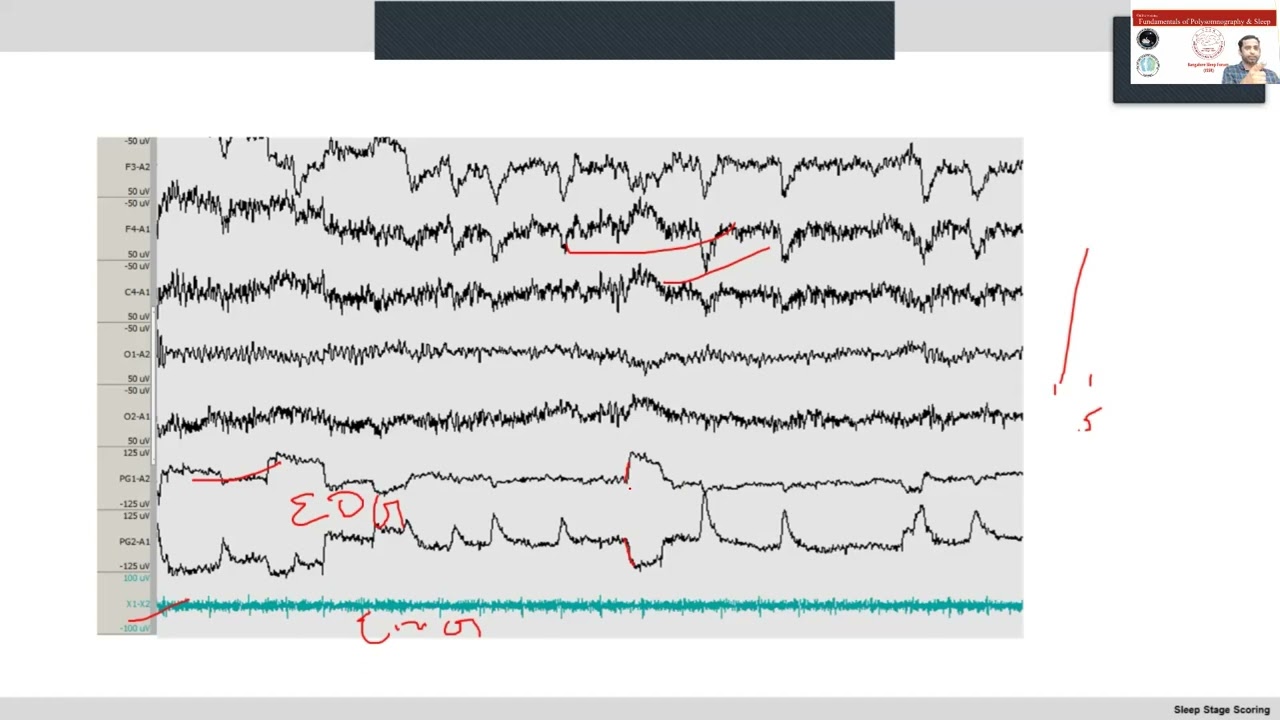 Scoring of sleep stages as per AASM 2017 guidelines