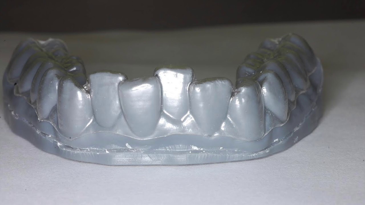 Clear Aligners 3D Printed by: Nirenblatt Orthodontics