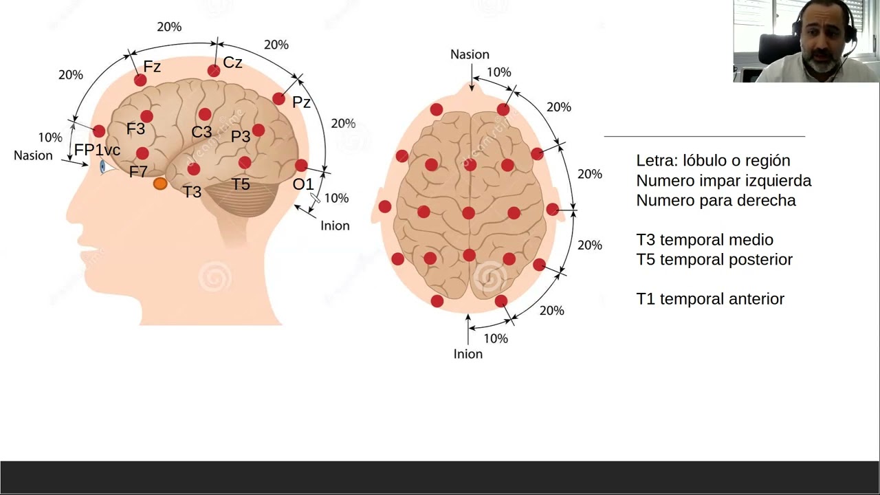 Introduc. monitoreo electrofisiológico normal y patológico en CTI. EEG y PEV. Dr  Hackembruch