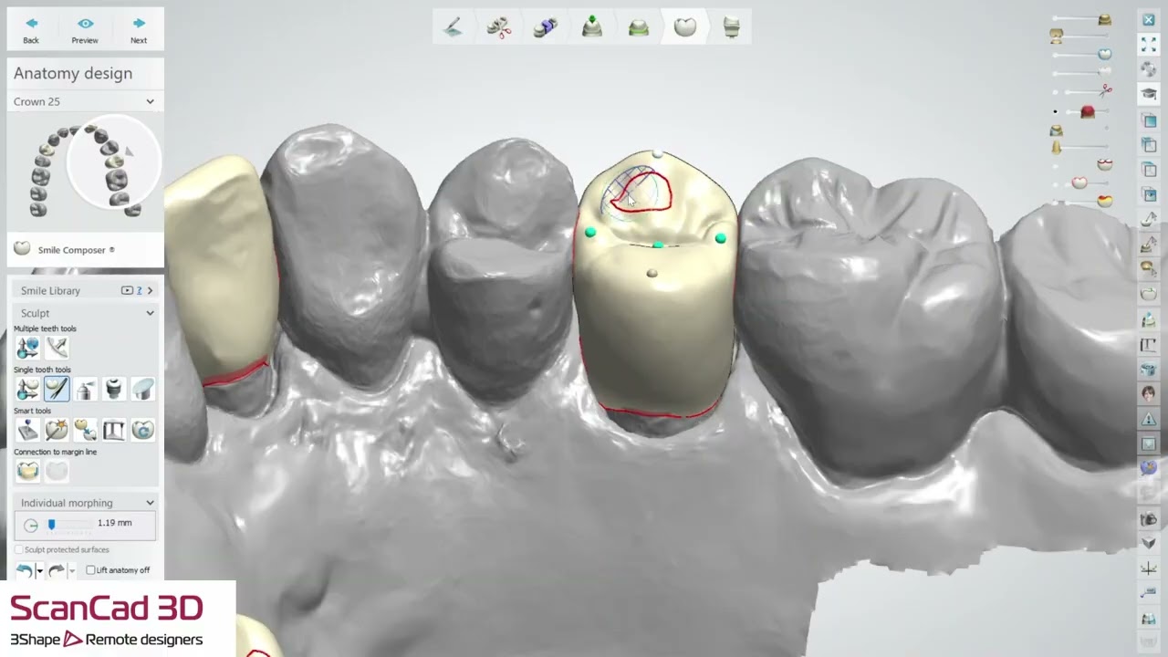 3shape crown #5,10,13