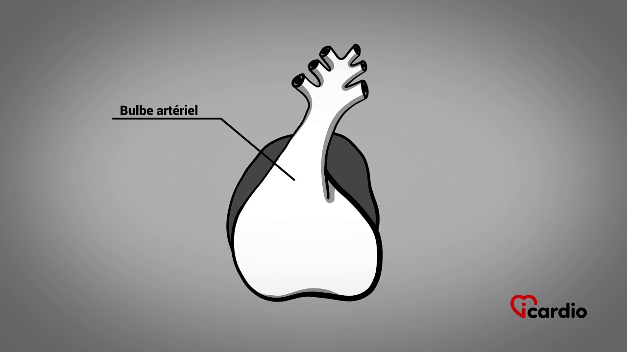Développement des ventricules et des gros vaisseaux artériels