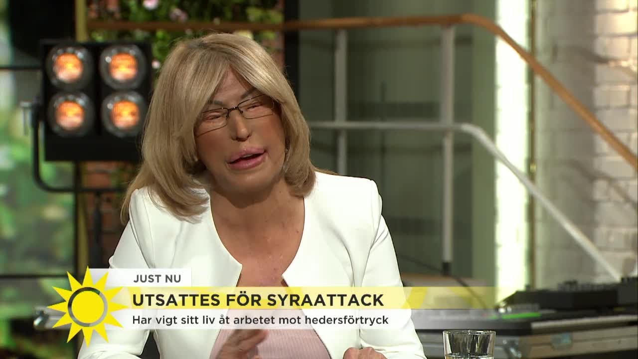 Utsattes för syraattack: Över hundra tusen unga lever under hedersförtryck - Nyhetsmorgon (TV4)