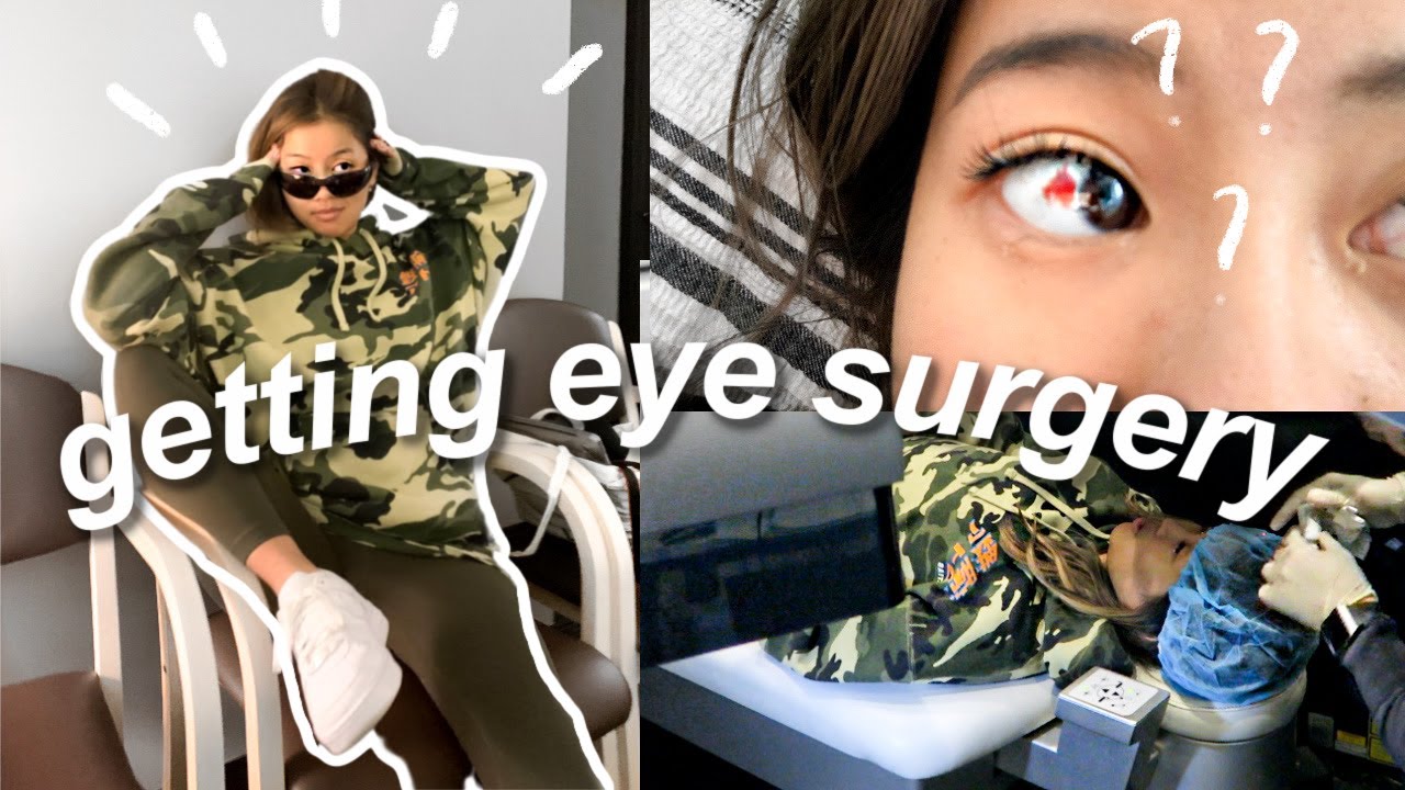 LASIK EYE SURGERY 101 | My Experience