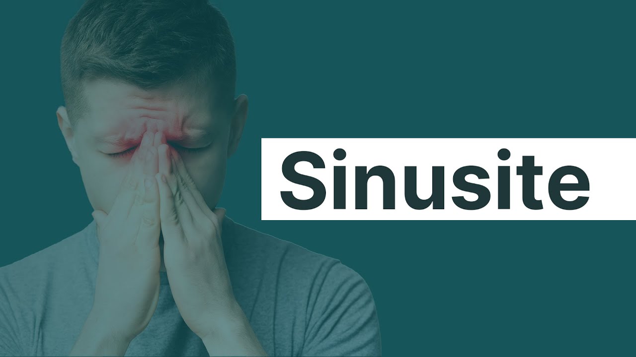 MEDICINA NA VIDA REAL: sinusite | Promedicina